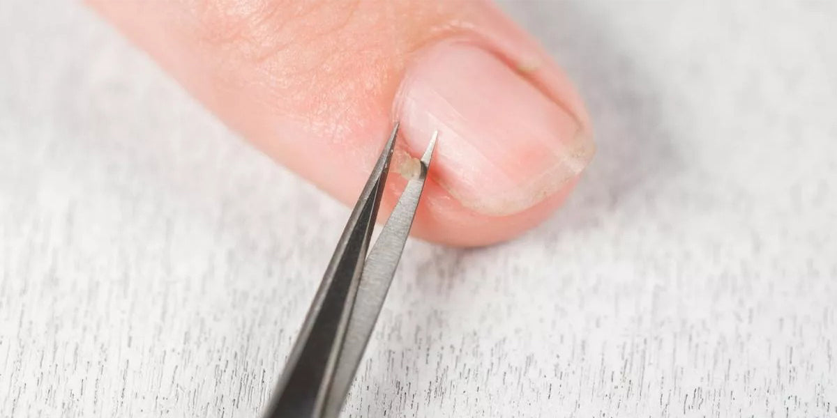 ¿POR QUÉ SALEN PADRASTROS EN LOS DEDOS?