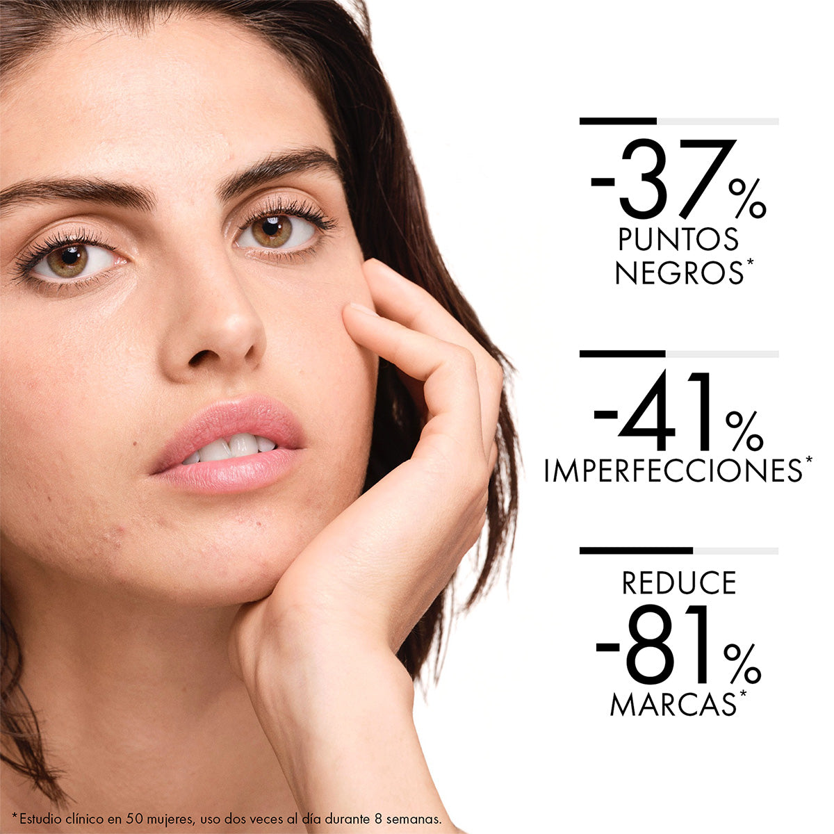 Vichy Normaderm phytosolution Corrige imperfecciones y regenera la piel 50 ml