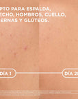 Bioderma Sébium Kerato+ Body Tratamiento Antiimperfecciones Corporal 150 ml