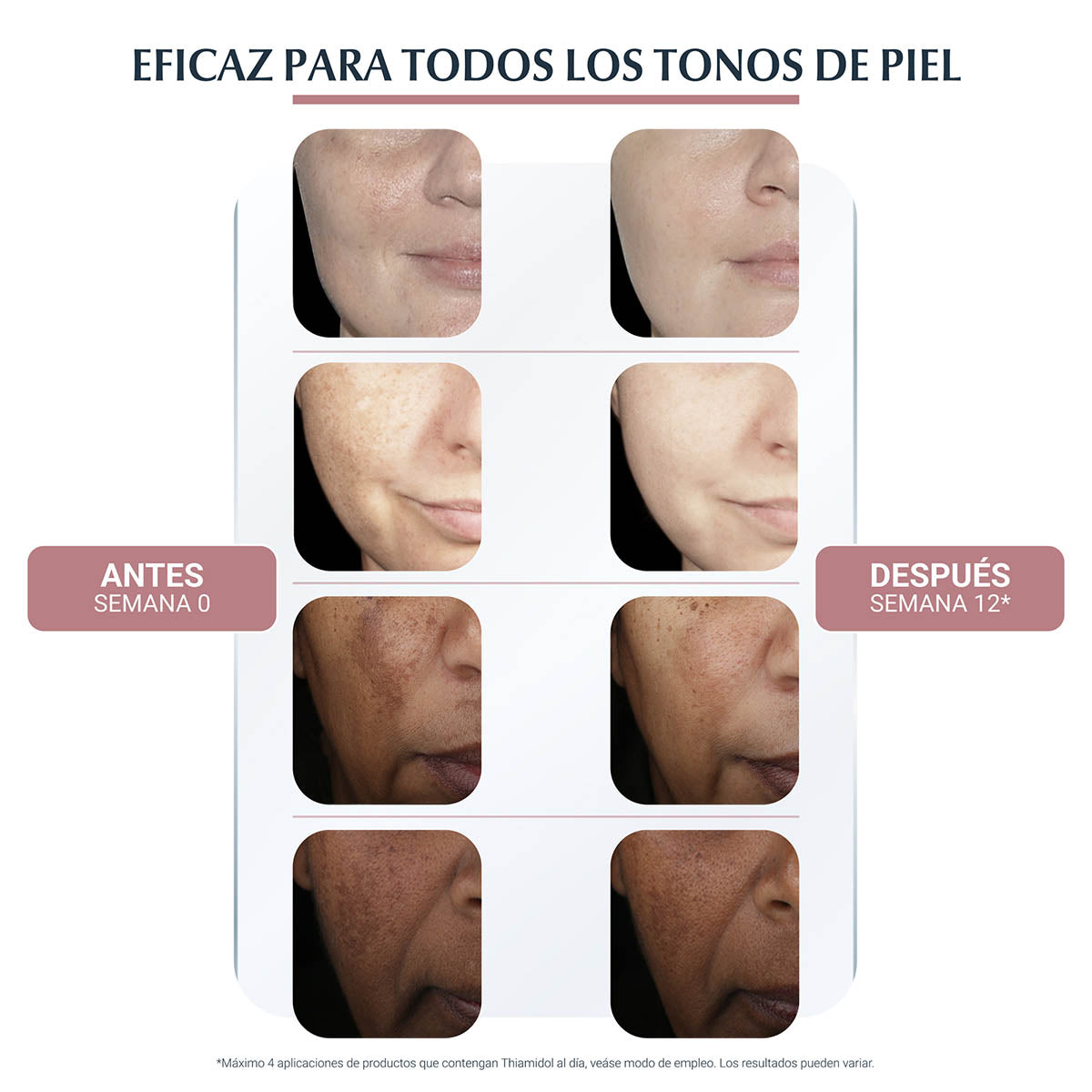 Eucerin anti-pigment crema facial de día anti-hiperpigmentación FPS30 50ml.