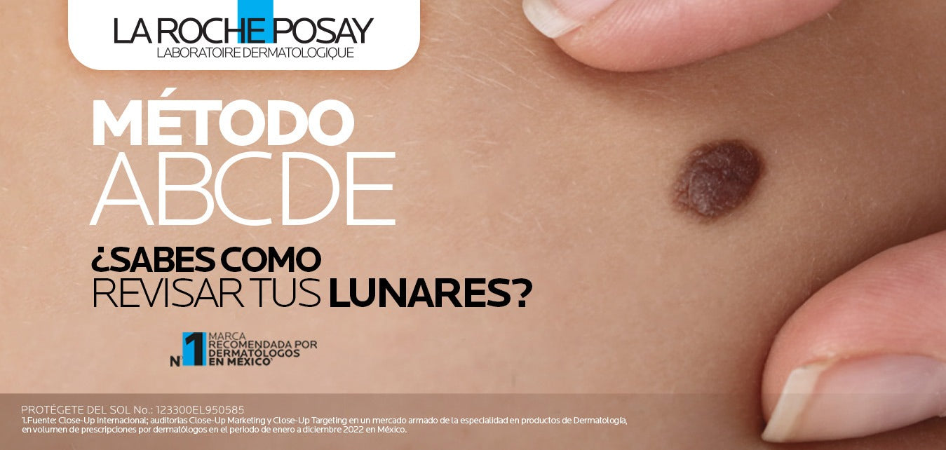 Examinar tus lunares es esencial para la salud de tu piel