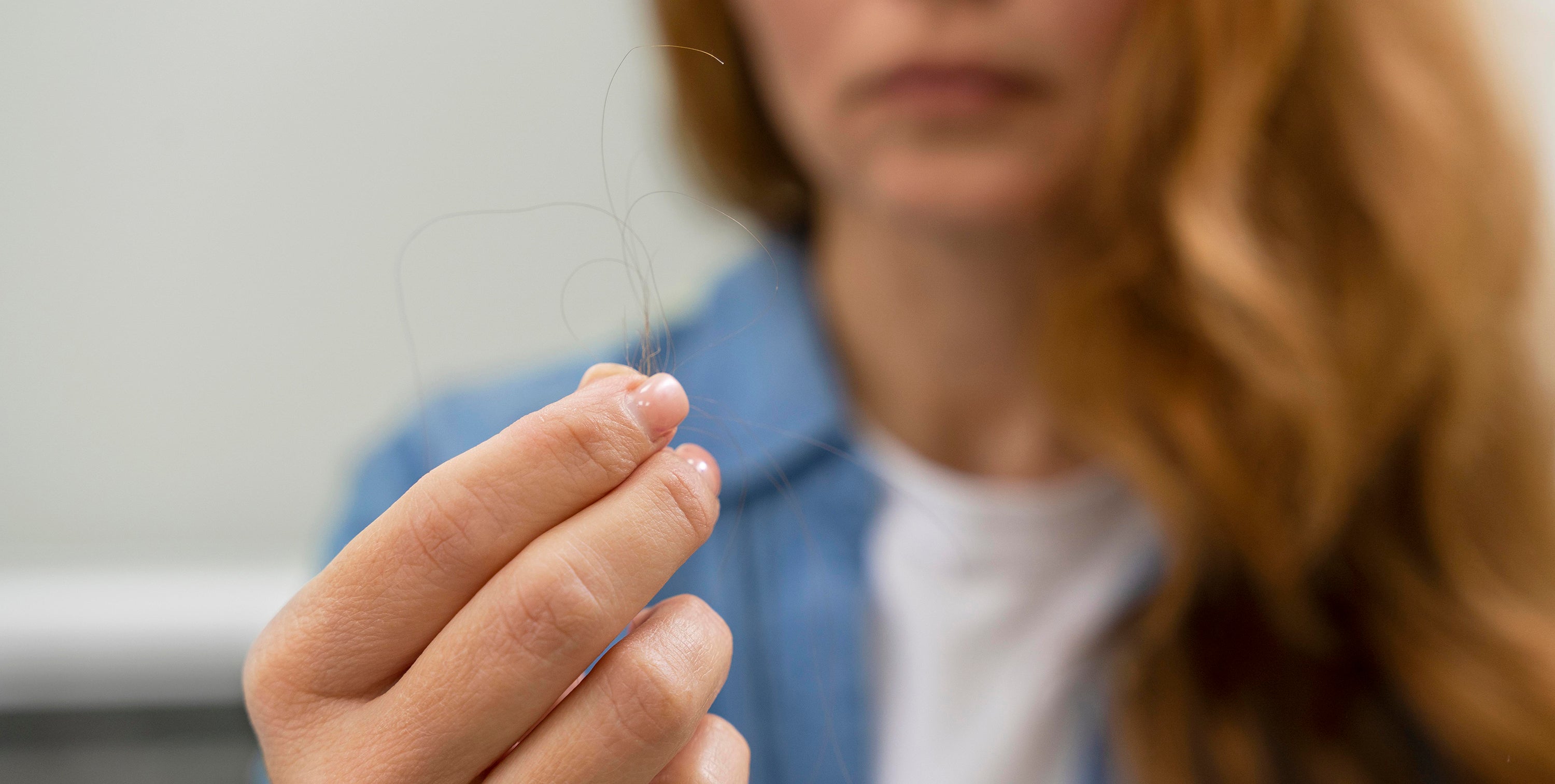Tipos de caída de cabello