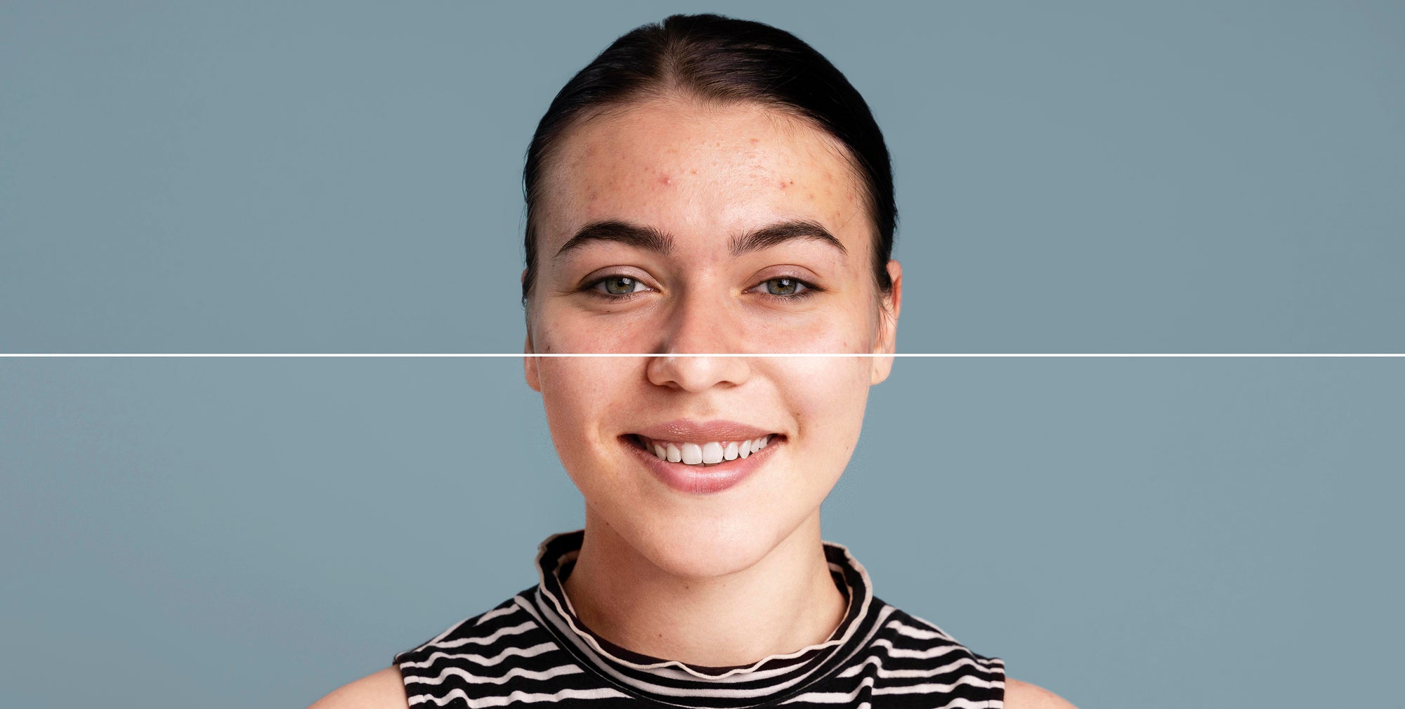 Ácido Glicólico: antiedad y antiimperfecciones