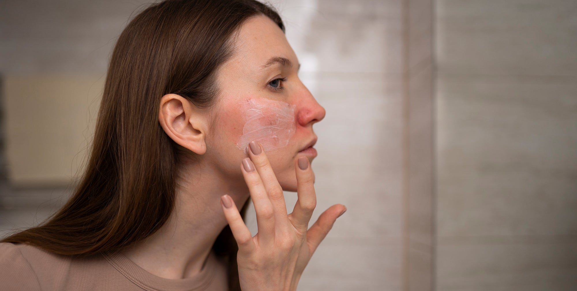 AZELOGLICINA, trata la rosácea y el acné