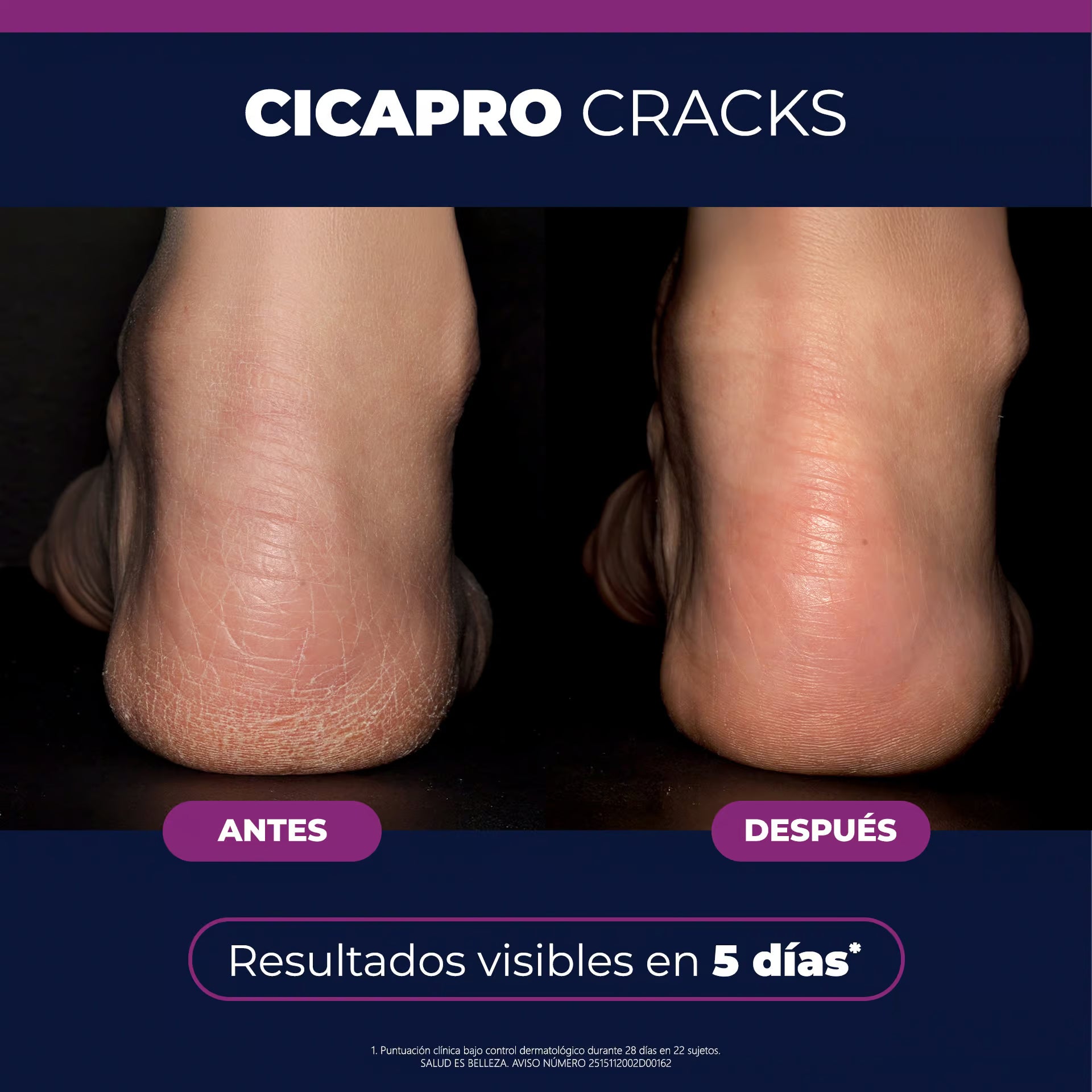 Isispharma Cicapro Cracks Reparador Bálsamo Reparador 40ml