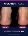 Isispharma Cicapro Cracks Reparador Bálsamo Reparador 40ml