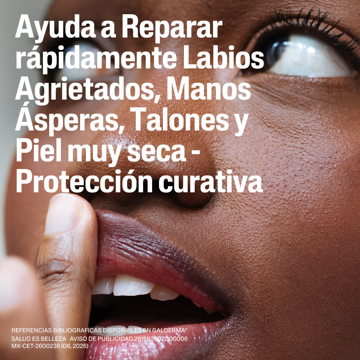 Cetaphil Bálsamo Multireparador 50 g
