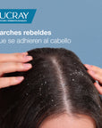 Ducray Kelual Squanorm Shampoo Caspa Grasa 200ml.