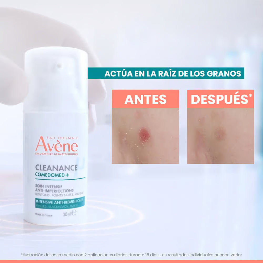 Avène Cleanance Comedomed Cuidado Intensivo Antiimperfecciones 30 ml