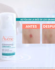 Avène Cleanance Comedomed Cuidado Intensivo Antiimperfecciones 30 ml