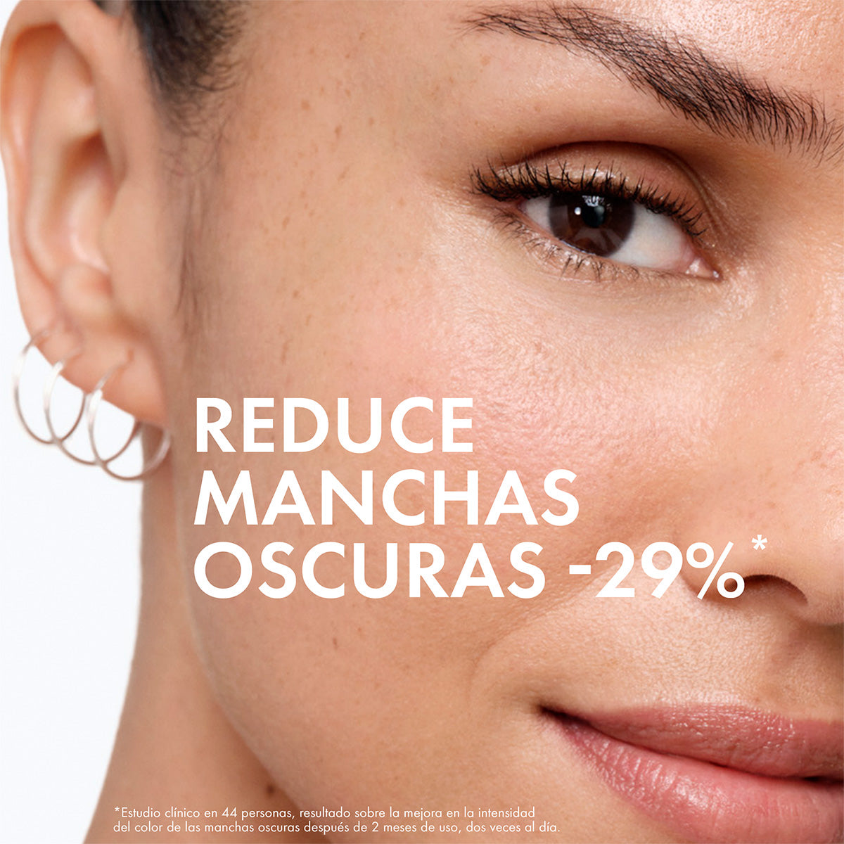 Vichy Liftactive Specialist B3 Serum, Corrigue manchas e unifica el tono de la piel, 30ml.