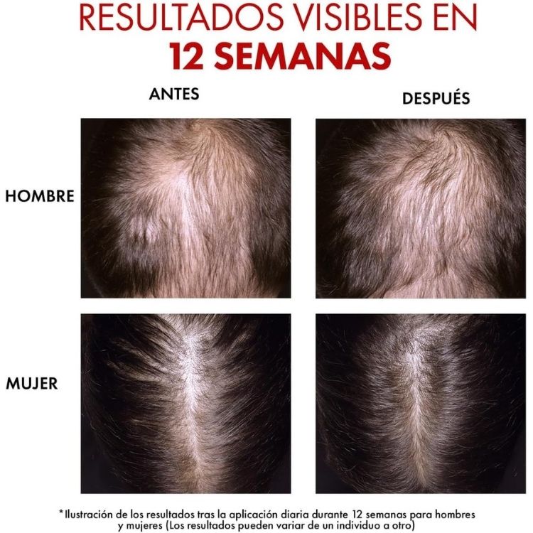 Vichy Dercos Regen Serum Fortalecedor Capilar Anticaída 50 ml