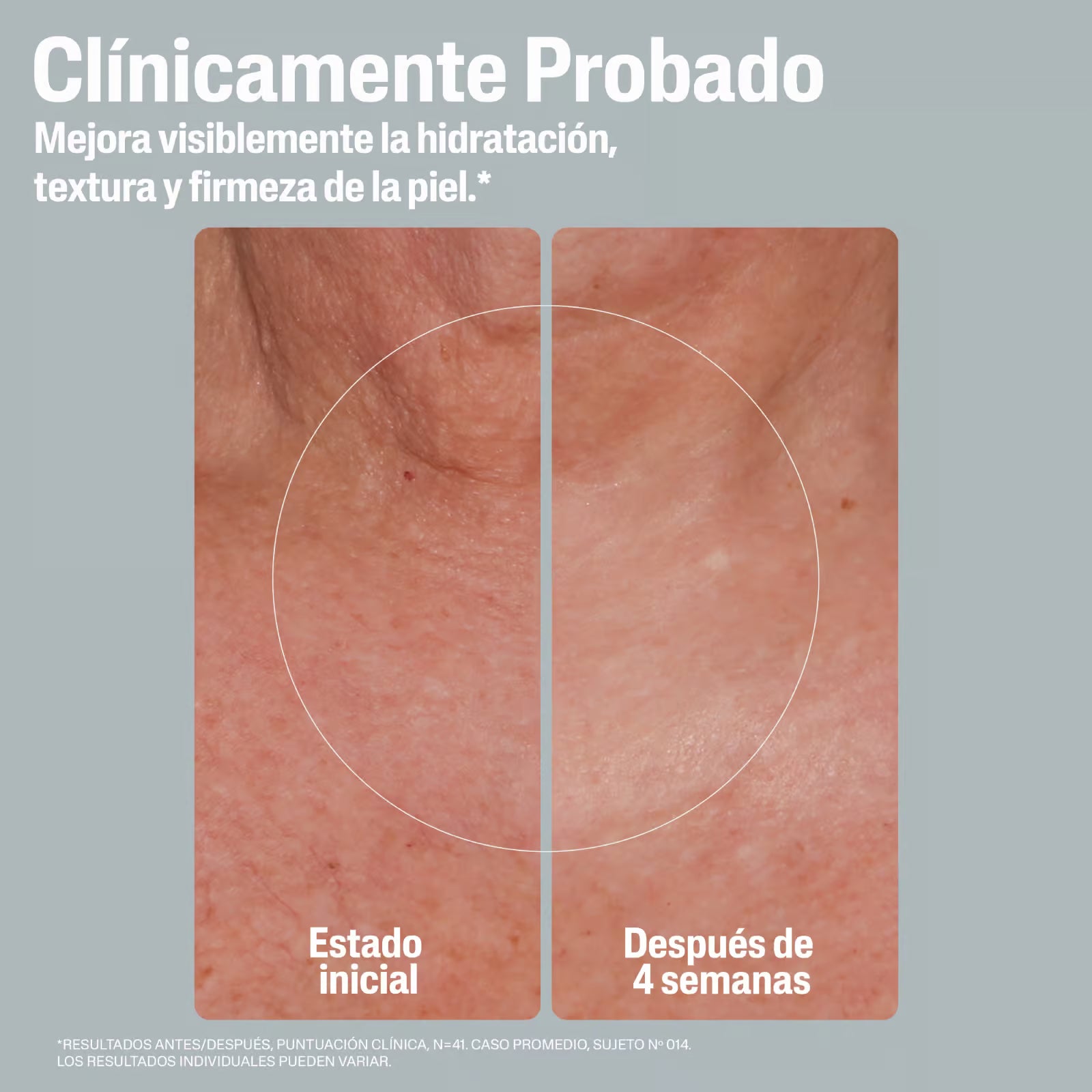 Cetaphil Skin Crema Hidratante Reafirmante 340 g