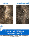 Uriage DS Shampoo anticaspa severa con Ácido Láctico 150ml.