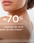 Bioderma Sébium Kerato+ Body Tratamiento Antiimperfecciones Corporal 150 ml