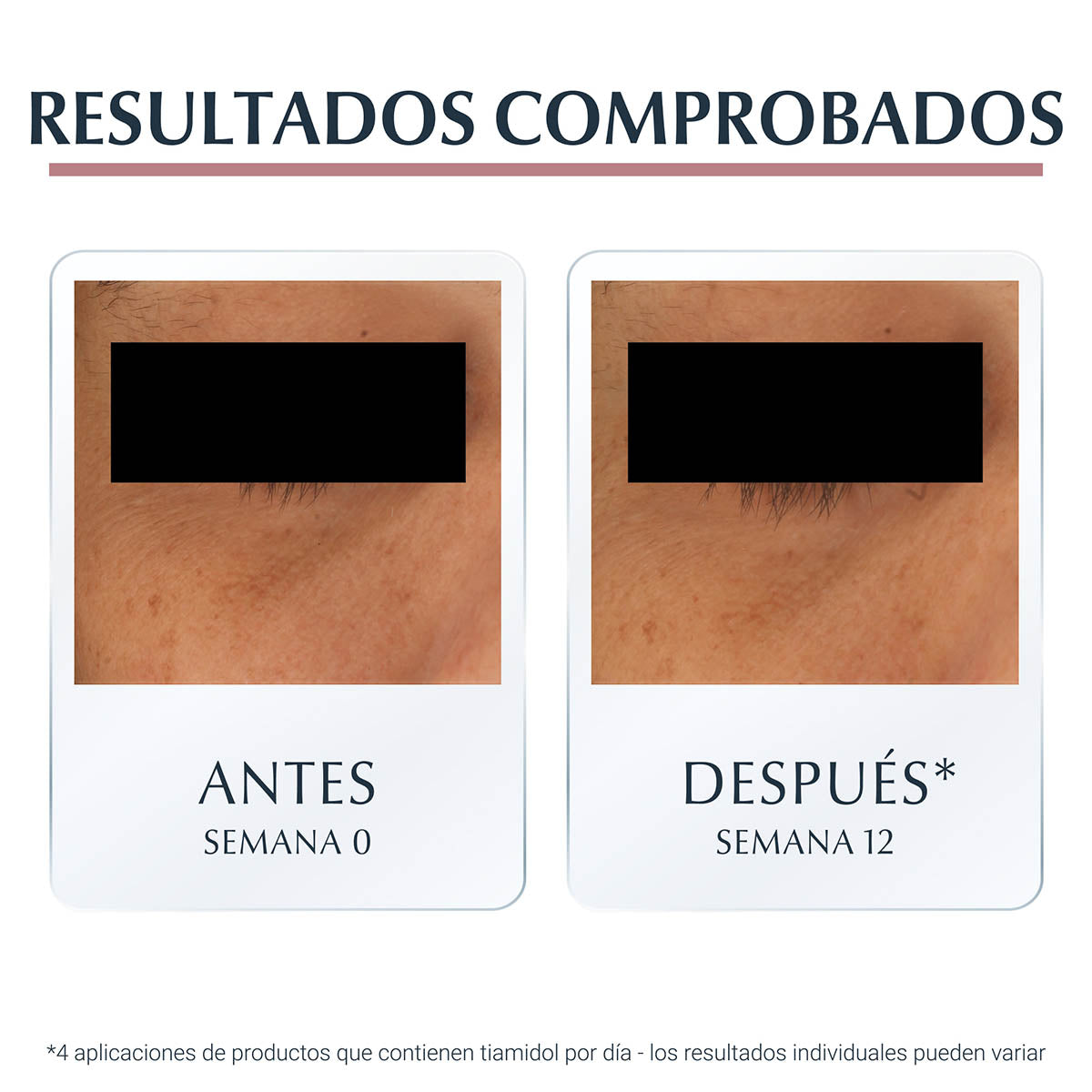 Eucerin Anti-pigment crema facial anti-ojeras 15ml.