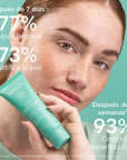 Apivita Just Bee Clear Crema Matificante 40ml.