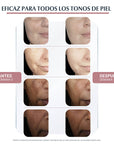 Eucerin Anti-pigment Dual serum facial anti-hiperpigmentación 30ml.