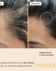 N&S Pack Regenador 4 Ampollas 10ml